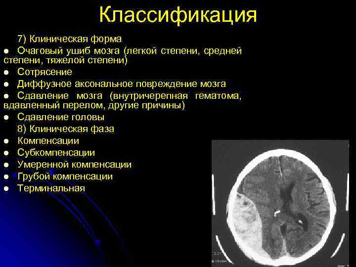 Гематома черепно мозговой травме. Классификация закрытых травм головного мозга. Ушиб мозга средней степени. Ушиб головного мозга классификация. Клиническая классификация ЧМТ.