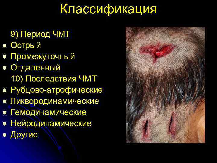Классификация l l l l 9) Период ЧМТ Острый Промежуточный Отдаленный 10) Последствия ЧМТ