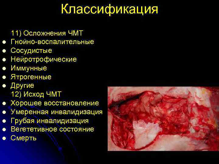 Классификация l l l 11) Осложнения ЧМТ Гнойно-воспалительные Сосудистые Нейротрофические Иммунные Ятрогенные Другие 12)