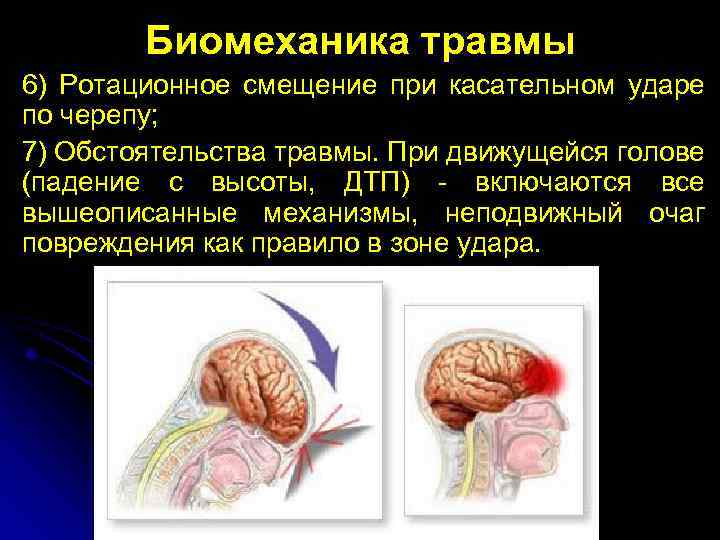 Биомеханика травмы 6) Ротационное смещение при касательном ударе по черепу; 7) Обстоятельства травмы. При