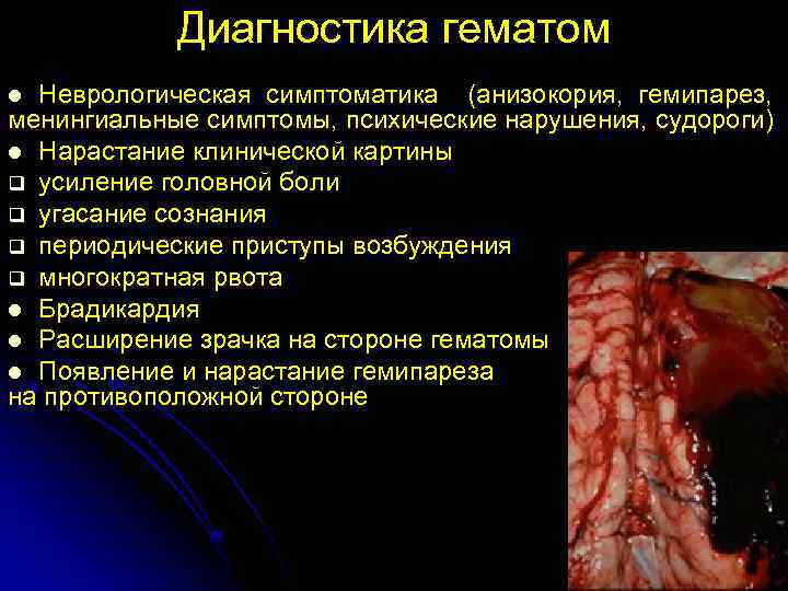 Диагностика гематом Неврологическая симптоматика (анизокория, гемипарез, менингиальные симптомы, психические нарушения, судороги) l Нарастание клинической