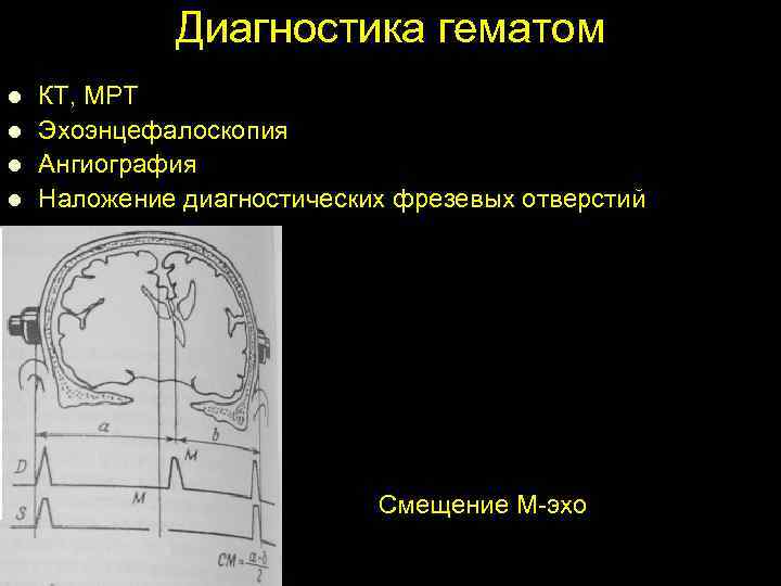 Диагностика гематом l l КТ, МРТ Эхоэнцефалоскопия Ангиография Наложение диагностических фрезевых отверстий Смещение М-эхо