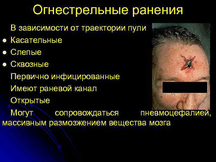 Огнестрельные ранения В зависимости от траектории пули l Касательные l Слепые l Сквозные Первично