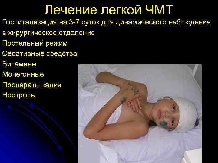 Лечение легкой ЧМТ Госпитализация на 3 -7 суток для динамического наблюдения в хирургическое отделение