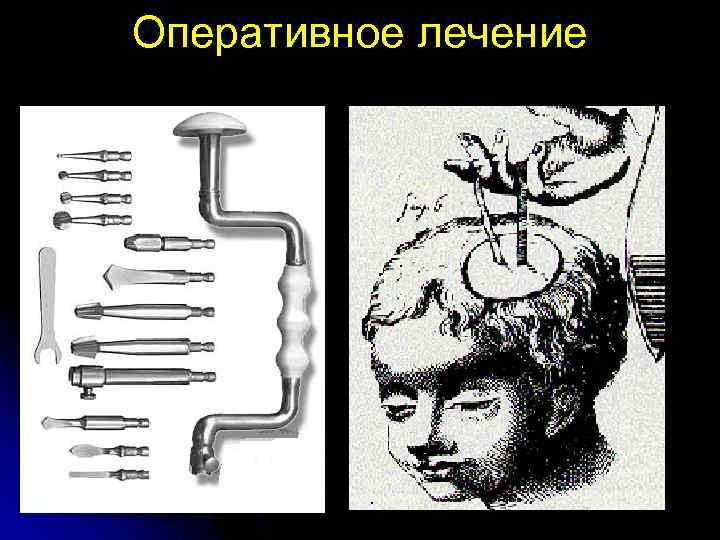 Оперативное лечение 