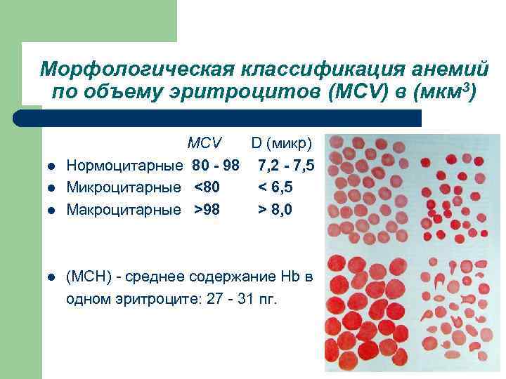 Морфологическая классификация анемий по объему эритроцитов (МСV) в (мкм 3) l l МСV D
