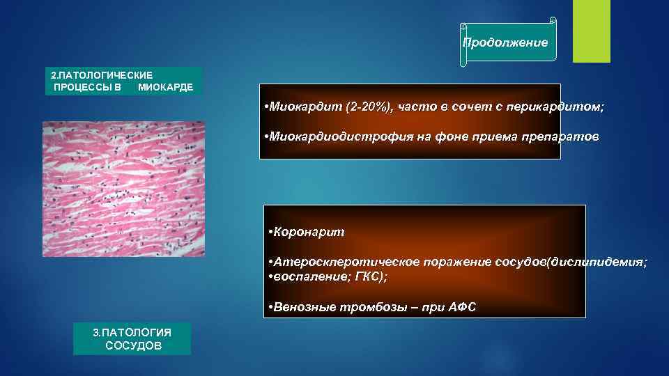 Продолжение 2. ПАТОЛОГИЧЕСКИЕ ПРОЦЕССЫ В МИОКАРДЕ • Миокардит (2 -20%), часто в сочет с