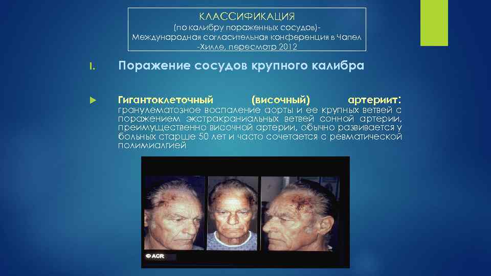 КЛАССИФИКАЦИЯ (по калибру пораженных сосудов) Международная согласительная конференция в Чапел Хилле, пересмотр 2012 I.