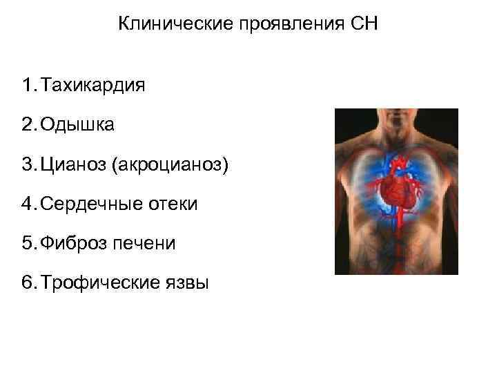 Клинические проявления СН 1. Тахикардия 2. Одышка 3. Цианоз (акроцианоз) 4. Сердечные отеки 5.