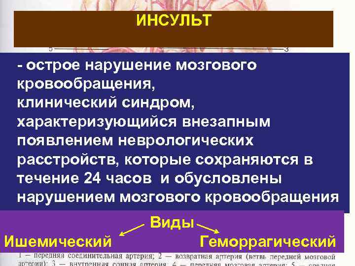 ИНСУЛЬТ - острое нарушение мозгового кровообращения, клинический синдром, характеризующийся внезапным появлением неврологических расстройств, которые