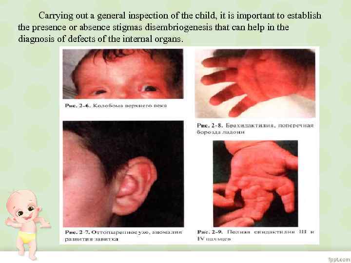 Carrying out a general inspection of the child, it is important to establish the