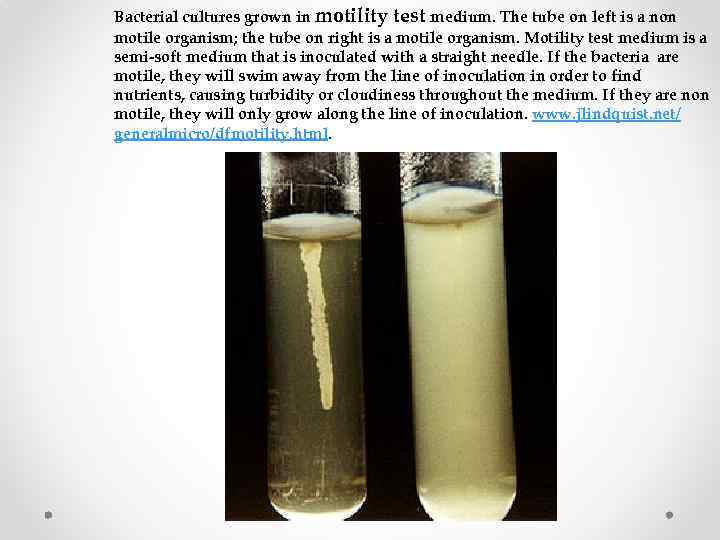 Bacterial cultures grown in motility test medium. The tube on left is a non