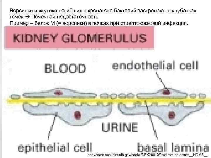 Ворсинки и жгутики погибших в кровотоке бактерий застревают в клубочках почек Почечная недостаточность Пример