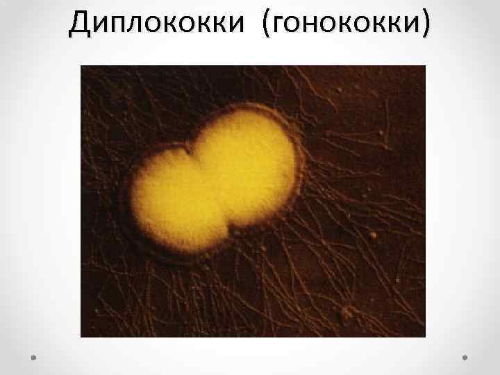 Диплококки (гонококки) 