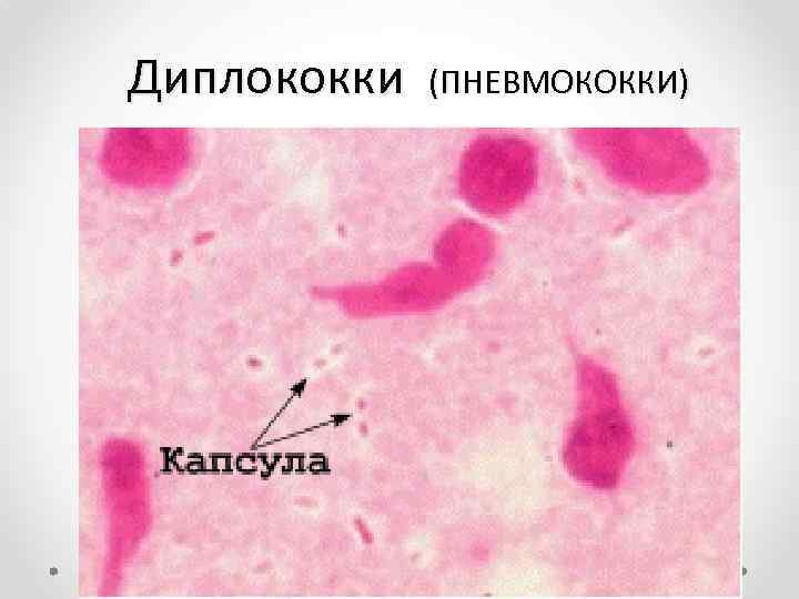 Диплококки (ПНЕВМОКОККИ) 