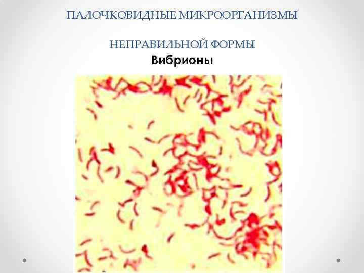 ПАЛОЧКОВИДНЫЕ МИКРООРГАНИЗМЫ НЕПРАВИЛЬНОЙ ФОРМЫ Вибрионы 