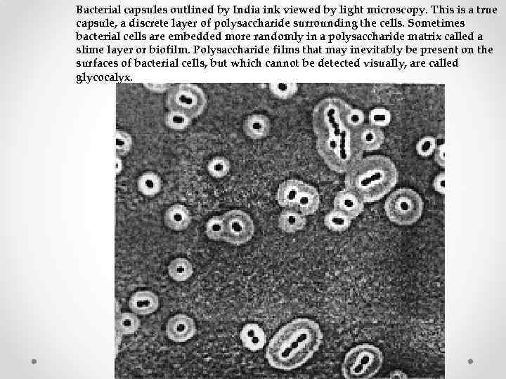 Bacterial capsules outlined by India ink viewed by light microscopy. This is a true