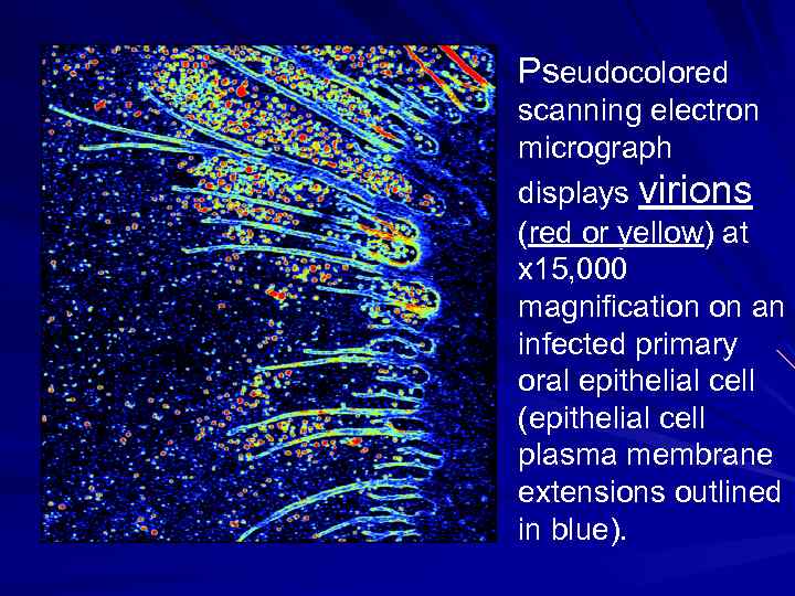 Pseudocolored scanning electron micrograph displays virions (red or yellow) at x 15, 000 magnification