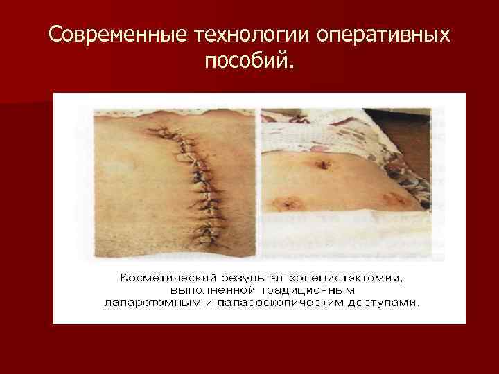 Современные технологии оперативных пособий. 