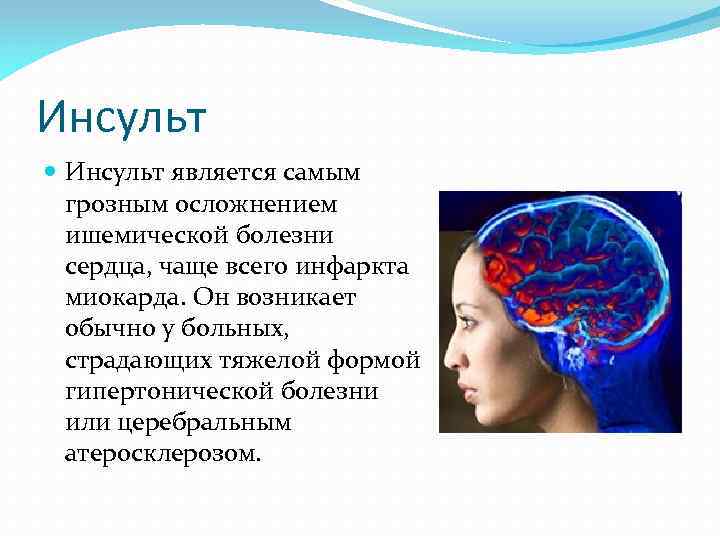 Инсульт является самым грозным осложнением ишемической болезни сердца, чаще всего инфаркта миокарда. Он возникает