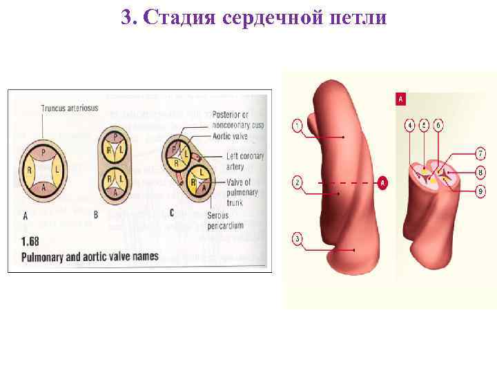 3. Стадия сердечной петли 