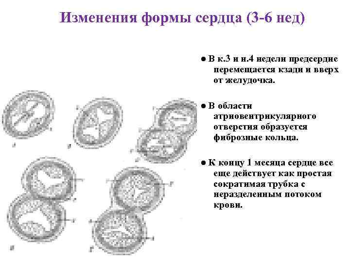 Изменения формы сердца (3 -6 нед) ● В к. 3 и н. 4 недели