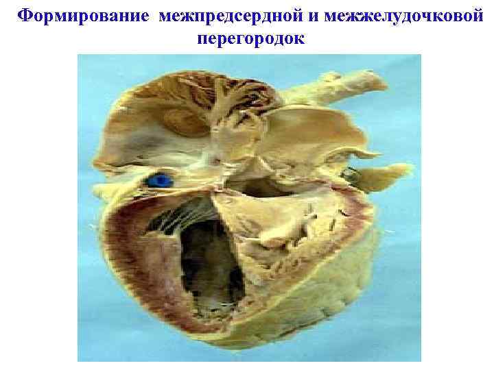 Формирование межпредсердной и межжелудочковой перегородок 