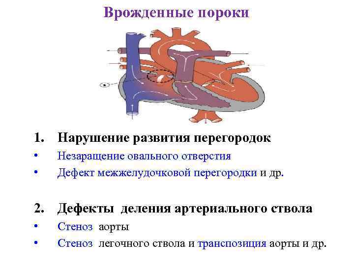 Врожденные пороки 1. Нарушение развития перегородок • • Незаращение овального отверстия Дефект межжелудочковой перегородки