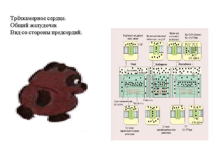 Трёхкамерное сердце. Общий желудочек Вид со стороны предсердий. 