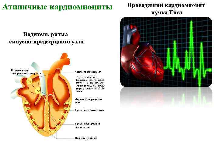 Атипичные кардиомиоциты Водитель ритма синусно-предсердного узла Проводящий кардиомиоцит пучка Гиса 