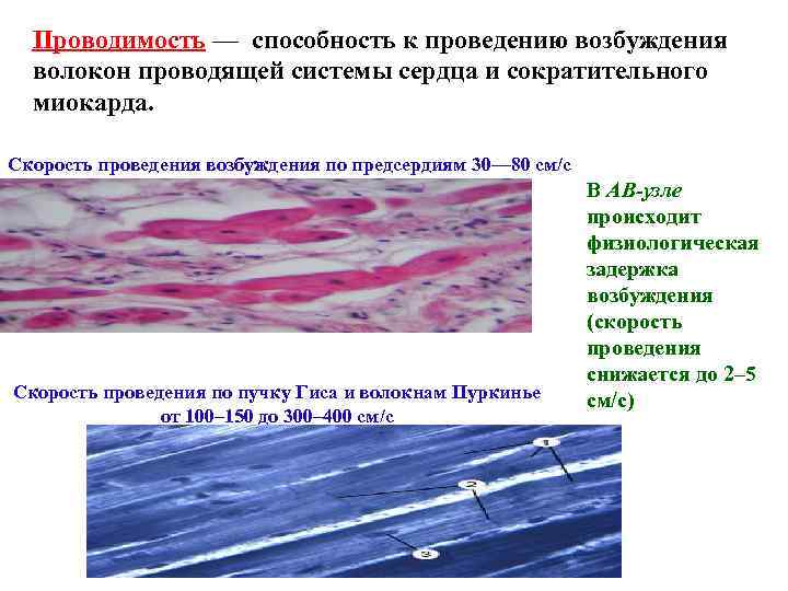 Проводимость — способность к проведению возбуждения волокон проводящей системы сердца и сократительного миокарда. Скорость