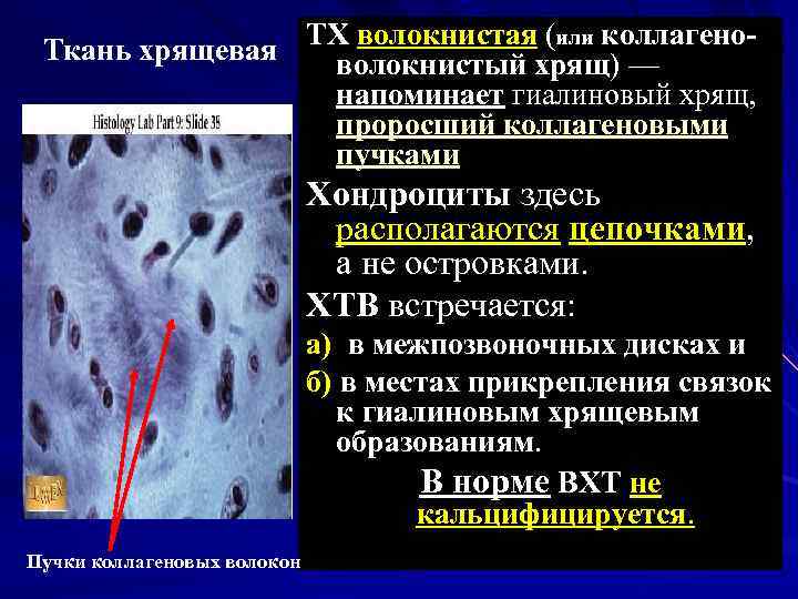 Ткань хрящевая ТХ волокнистая (или коллагено волокнистый хрящ) — напоминает гиалиновый хрящ, проросший коллагеновыми
