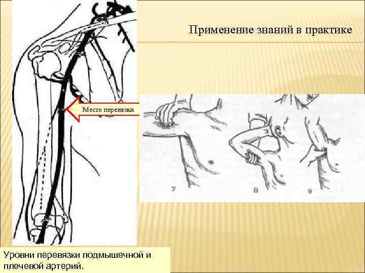 Подмышечная артерия схема рисунок