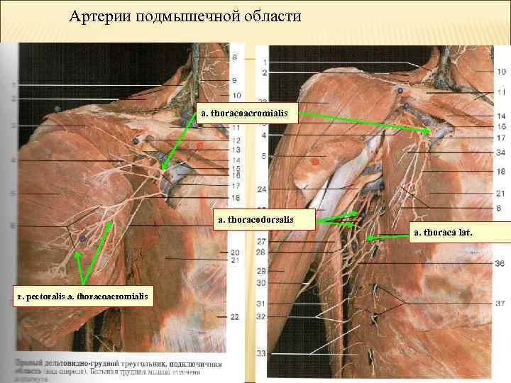 Артерии подмышечной области a. thoracoacromialis a. thoracodorsalis a. thoraca lat. r. pectoralis a. thoracoacromialis