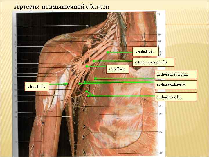 Артерии подмышечной области a. subclavia a. thoracoacromialis a. axillaris a. thoraca suprema a. brachialis