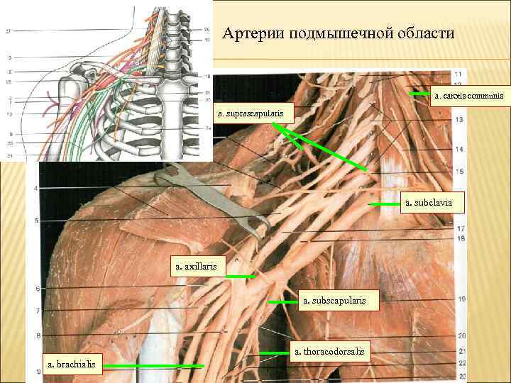 Артерии подмышечной области a. carotis communis a. suprascapularis a. subclavia a. axillaris a. subscapularis