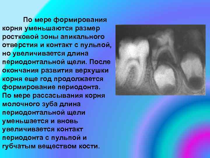 По мере формирования корня уменьшаются размер ростковой зоны апикального отверстия и контакт с пульпой,