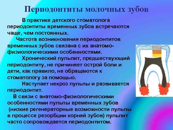 Периодонтиты молочных зубов В практике детского стоматолога периодонтиты временных зубов встречаются чаще, чем постоянных.