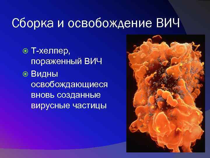 Сборка и освобождение ВИЧ Т-хелпер, пораженный ВИЧ Видны освобождающиеся вновь созданные вирусные частицы 