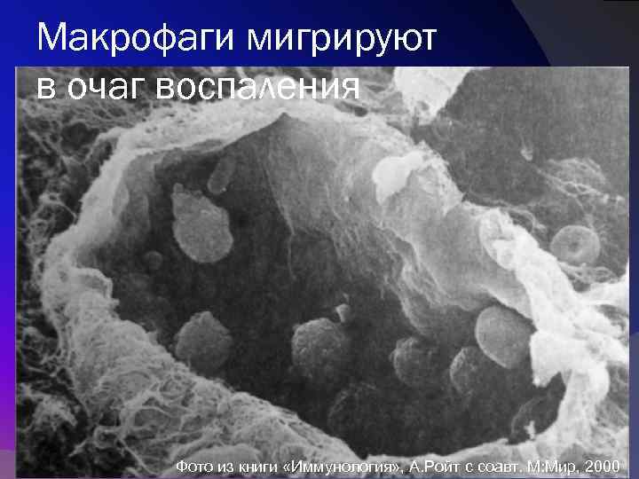 Эритроциты макрофаги. Воспаление макрофаги. Макрофаги под микроскопом. Фагоцитоз в очаге воспаления. Роль фагоцитоза в воспалительной реакции.