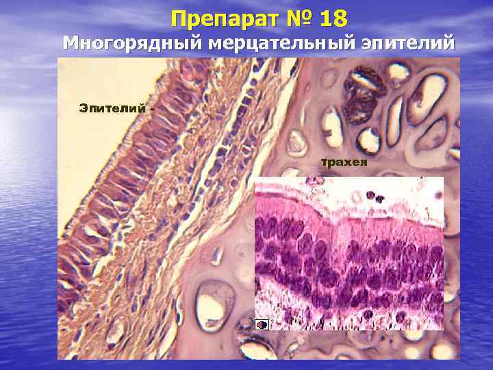 Препарат № 18 Многорядный мерцательный эпителий Эпителий - трахея 