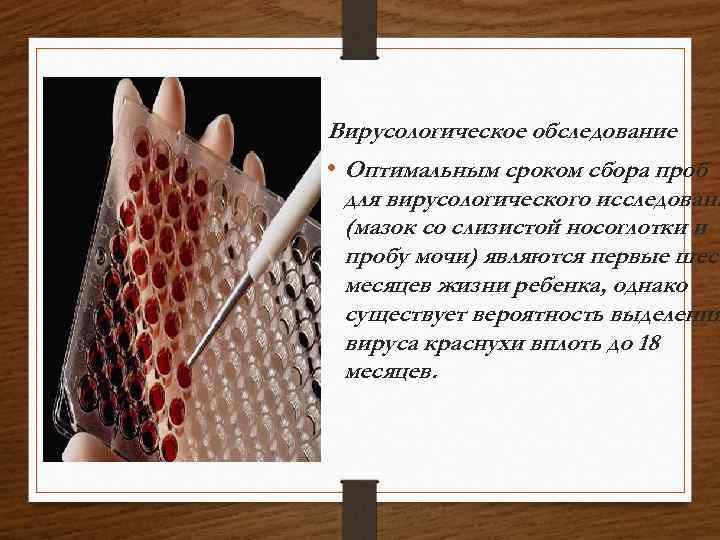 Вирусологическое обследование • Оптимальным сроком сбора проб для вирусологического исследовани (мазок со слизистой носоглотки