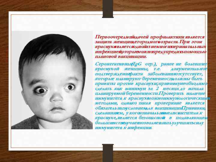  • Первоочередной задачей профилактики является защита женщиндетородного возраста. При этом краснуха являетсяодной немногих
