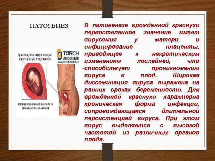 ПАТОГЕНЕЗ В патогенезе врожденной краснухи первостепенное значение имеет вирусемия у матери и инфицирование плаценты,