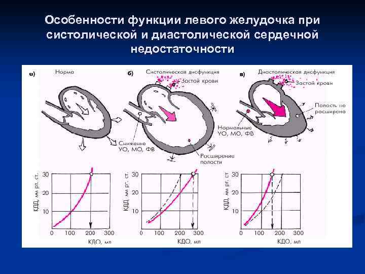 Особенности функции левого желудочка при систолической и диастолической сердечной недостаточности 