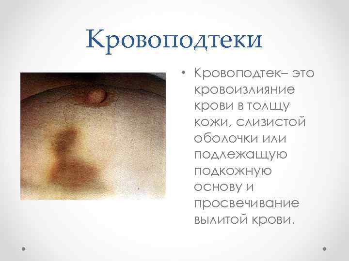 Кровоподтеки • Кровоподтек– это кровоизлияние крови в толщу кожи, слизистой оболочки или подлежащую подкожную