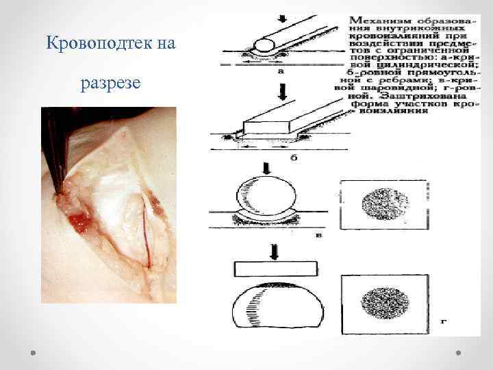 Кровоподтек на разрезе 