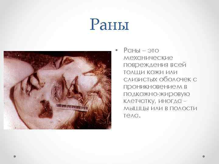 Раны • Раны – это механические повреждения всей толщи кожи или слизистых оболочек с