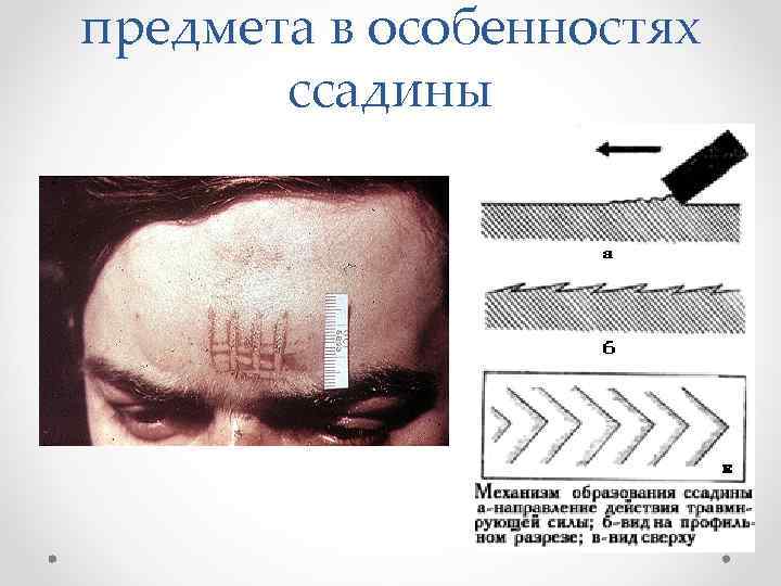 предмета в особенностях ссадины 