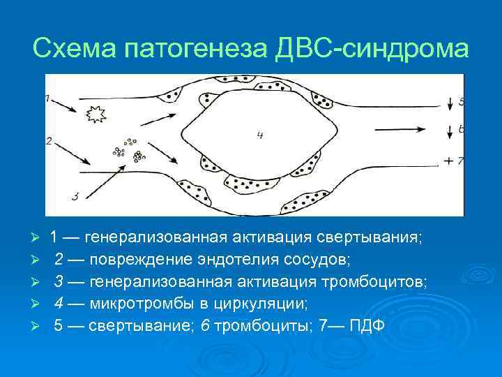 Схема патогенеза ДВС-синдрома Ø Ø Ø 1 — генерализованная активация свертывания; 2 — повреждение